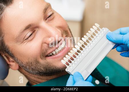 Zahnarzt verwendet eine Palette Zahnfarbe Probe, um den Farbton der männlichen Zähne des Patienten zu bestimmen. Stomatologe verwenden die Farbe der Zähne, um Veneers, Kronen und de zu machen Stockfoto