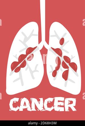 Flache Cartoon Lungenkrebs Vektor-Illustration auf einem roten Hintergrund. Stock Vektor