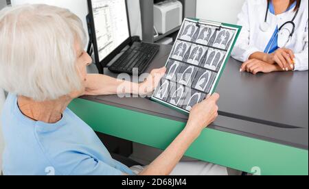 Ältere Patienten halten die Ergebnisse eines CT-Scans der Lunge. Lungenentzündung, Bronchitis und Coronavirus Stockfoto