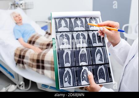 Close-up-CT-Lungenscreening. Diagnostik und Behandlung von Patienten mit Pneumonie und Lungenerkrankungen im Krankenhaus. Patient auf einer Krankenhausstation Stockfoto