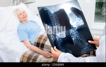 Ein erfahrener Arzt hält eine Röntgenaufnahme der Halswirbelsäule älterer Frauen. Behandlung von Wirbelsäulenerkrankungen, Osteochondrose und Zervixhernie. Schließen- Stockfoto