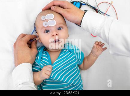 Hörscreening für Neugeborene und Diagnose im Krankenhaus. Baby mit Hörscreening mit speziellen Elektroden an Kopf und Ohr Stockfoto