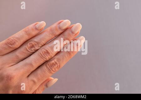 Nägel mit nachwachsendem Gelpolitur. Die Frau konnte wegen der Notwendigkeit, die soziale Isolation zu beobachten, keine Maniküre rechtzeitig bekommen. Nagelstudios sind geschlossen Stockfoto