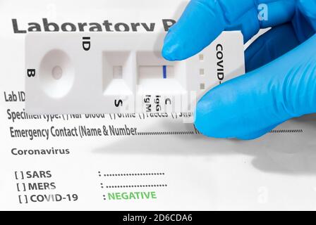 Die Hand eines Arztes oder eines Laboranten zeigt einen schnellen COVID-19-Labortest zum Nachweis von IgM- und IgG-Antikörpern gegen das neue Coronavirus SARS-CoV-2 wit Stockfoto