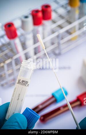 Abbildung zu den beiden Covid 19 Tests, Blutserologie und PCR. Stockfoto