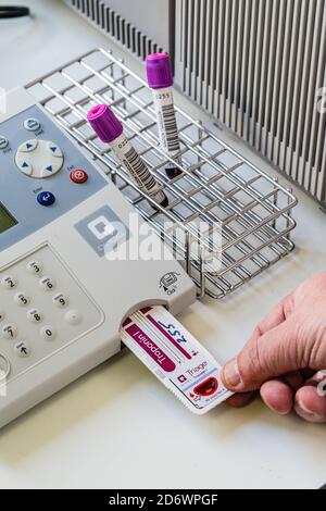 Troponin, Blutprobe bei Verdacht auf Myokardinfarkt. Stockfoto