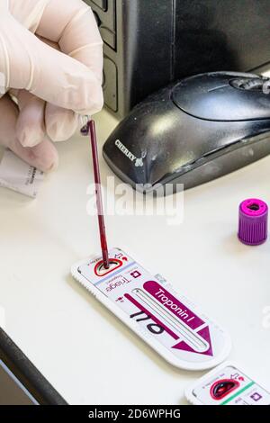 Troponin, Blutprobe bei Verdacht auf Myokardinfarkt. Stockfoto