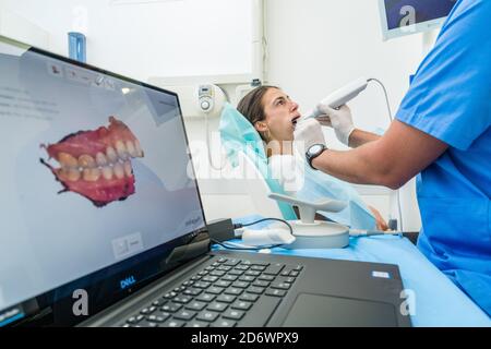 Digitaler Zahnabdruck mit intraoraler Kamera für die Realisierung einer Zahnprothese, Centre COSEM Paris. Stockfoto