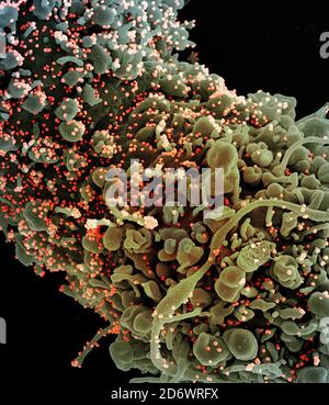 Eingefärbtes Rasterelektronenmikrograph einer Zelle mit morphologischen Anzeichen einer Apoptose, infiziert mit SARS-COV-2-Viruspartikeln (orange), isoliert Stockfoto