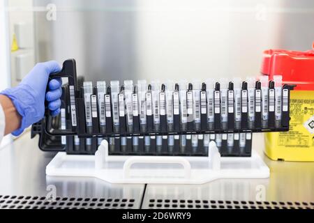 Laden der Reagenzien von COVID-19 Screening-PCR-Testproben in die automatische Maschine, Krankenhaus-Analyselabor Limoges, Frankreich. Stockfoto