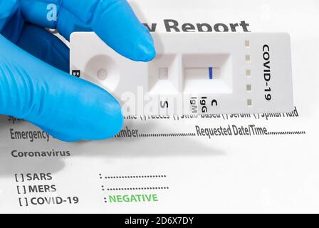 Die Hand eines Arztes oder eines Laboranten zeigt einen schnellen COVID-19-Labortest zum Nachweis von IgM- und IgG-Antikörpern gegen das neue Coronavirus SARS-CoV-2 wit Stockfoto