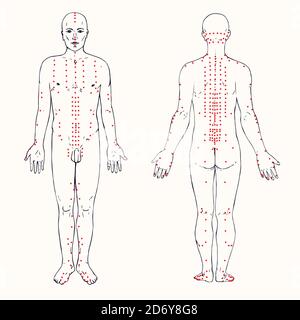 Body Set (vorne und hinten) Akupunkturschema mit roten Punkten, handgezeichneter Doodle, Skizze im Pop Art Stil, schwarz-weiße medizinische Illustration Stockfoto