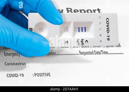 Die Hand eines Arztes oder eines Laboranten zeigt einen schnellen COVID-19-Labortest zum Nachweis von IgM- und IgG-Antikörpern gegen das neue Coronavirus SARS-CoV-2 wit Stockfoto