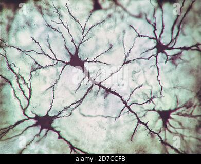 2D-Illustration, Neuronen und ihre Verbindungen. Mikroskopische Fotosimulation des menschlichen Nervensystems. Stockfoto