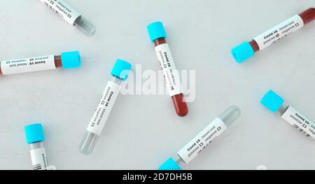 Teströhrchen mit Blut gefüllt, Tests in einem Labor für Covid-19 . Medizinisches Screening mit Coronavirus. Blutproben in Glasröhrchen. 3d-Rendering. Stockfoto