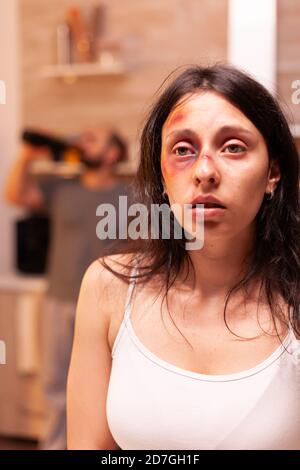 Frau in Schmerzen suferring, nachdem Brutalität von betrunkenen gewalttätigen Ehemann in Wut rampage geschlagen. Gewalttätige aggressive Mann singen verletzt verängstigt hilflos, verletzlich, Angst, geschlagen und in Panik Ehefrau, Opfer. Stockfoto