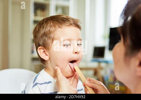 Kinderarzt untersucht Zunge eines Kindes mit Mandelentzündung mit einem Spachtel Stockfoto