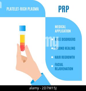 Thrombozytenreiches Plasma (PRP) medizinische Verwendung, Illustration Stockfoto
