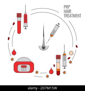 Thrombozytenreiches Plasma (PRP) Behandlung, Illustration. Stockfoto