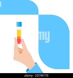 Thrombozytenreiches Plasma (PRP) medizinische Verwendung, Illustration Stockfoto