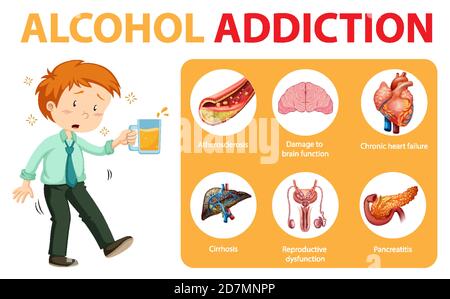 Informationen zur Alkoholabhängigkeit oder Alkoholismus Infografik Illustration Stock Vektor