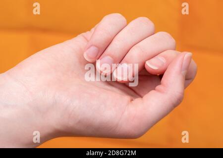 Nahaufnahme der weiblichen Hand mit langen rohen Nägeln auf einer Orange Hintergrund Stockfoto