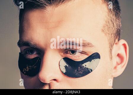 Mann Gesicht mit Flocken unter den Augen. Mans Flocken. Flecken unter engen Augen für den Menschen. Akupressur, massieren seine Schläfen, Flocken Kollagen. Stockfoto