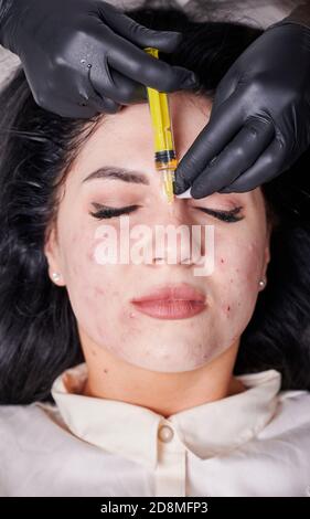 Nahaufnahme einer Patientin mit problematischer Haut, die im Wellnesscenter Injektionen erhält. Arzt Kosmetologe macht Injektion in der Nase des Patienten. Konzept der Schönheitsbehandlung und Hautpflege Behandlung. Stockfoto