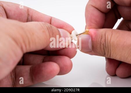 Serie von schmerzhaften Fingernagel Haut Infektion mit Eiter reatment Stockfoto