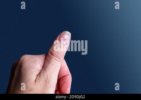 Nahaufnahme eines verletzten Fingers mit offenem Schnitt auf blauem Hintergrund, Kopierbereich. Konzept für ein Trauma im Haushalt Stockfoto