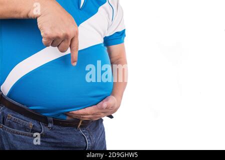 Mann zeigt eigenen ungesunden großen Bauch mit viszeralen subkutanen Fetten Stockfoto