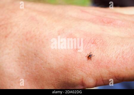 Skalentick, harte Milbe der Familie Ixodidae auf menschlicher Hand. Es Träger von Krankheitserregern, die menschliche Krankheit verursachen können. Stockfoto