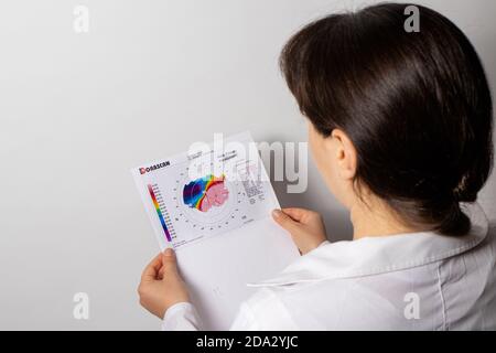 Dünner werdendes Hornhautdystrophie, Augen-Keratotopographie. Stockfoto