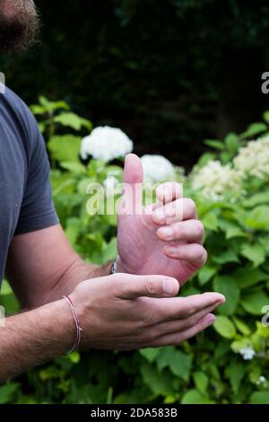 Nahaufnahme der Hände eines Mannes, zusammen und Druck Meridian Punkte auf die Hände, Therapie Stockfoto