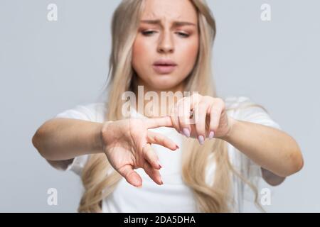 Frau mit Fingerschmerzen, Stretching-Übungen und Massage für die Finger nach der Arbeit am Computer. Handarthritis, Office-Syndrom Konzept Stockfoto