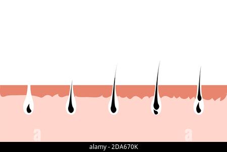 Haarwuchszyklus Haut. Follikel Anatomie Anagen Phase, Haarwachstum Diagramm Illustration Stock Vektor