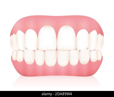 Zahnersatz. Falsche Zähne - Abbildung auf weißem Hintergrund. Stockfoto