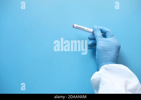 Labortechniker Hand hält Blutprobe Rohr Stockfoto