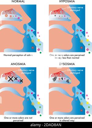 Die Illustration zeigt auf symbolische und einfache Weise die Symptome von drei verschiedenen olfaktorischen Erkrankungen. Stock Vektor