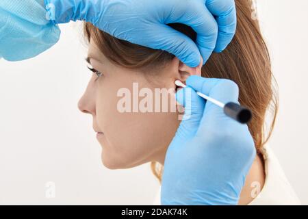 Ohrenkontrolle mit Wattestäbchen im medizinischen Labor Stockfoto