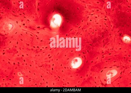 Menschliches, kompaktes Knochengewebe, leichte Mikrograph. Stockfoto