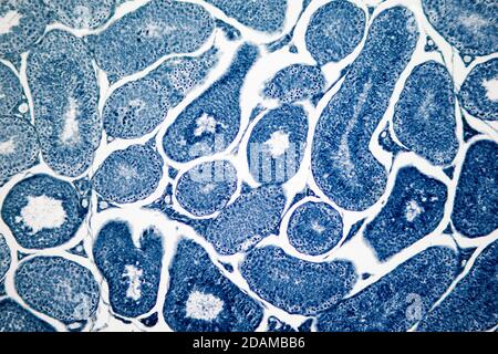 Humaner Hoden, leichte Mikrograph. Hier sehen Sie Spermatogonien, Spermatozyten, die sich einer Meiose unterziehen, Spermatiden und Spermatozoen. Stockfoto