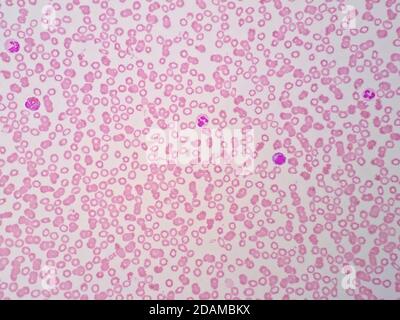 Menschliche Blutzellen, leichte Mikrograph. Stockfoto