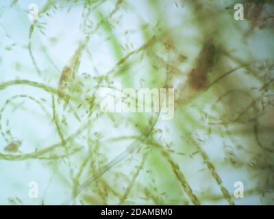 Filamentalgen, leichte Mikrograph. Filamentalgen sind einzelne Algenzellen, die lange sichtbare Ketten, Fäden oder Filamente bilden. Stockfoto