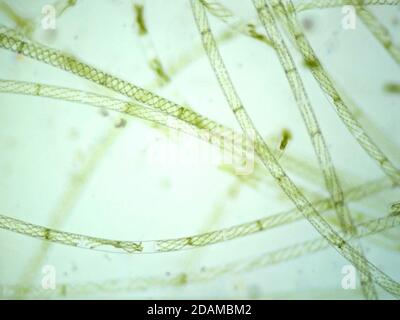 Filamentalgen, leichte Mikrograph. Filamentalgen sind einzelne Algenzellen, die lange sichtbare Ketten, Fäden oder Filamente bilden. Stockfoto