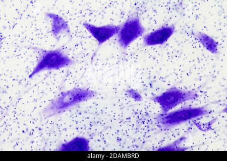 Licht-Mikrograph von Nervenzellen (Neuronen) aus dem Gehirn. Stockfoto