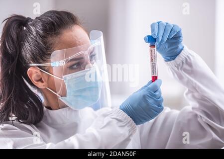 Labormitarbeiter mit Schutzausrüstung untersucht eine Ampulle mit einem Covid-19-Test. Stockfoto