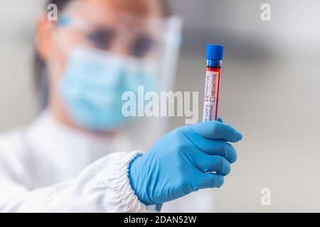 Krankenhausmitarbeiter, die PSA tragen, halten eine Ampulle des positiven neuartigen Coronavirus 2019-nCoV-Tests. Stockfoto