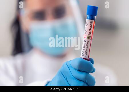 Weibliche Sanitäter hält einen negativen Coronavirus-Test in der Hand. Stockfoto
