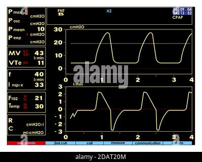 Bildschirm, Monitor mit Anzeichen der künstlichen Lungenventilation Gerät in einem realistischen Design. Isolierter Vektor Stock Vektor